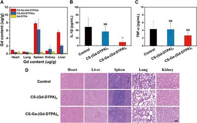 Liver-targeting MRI contrast agent based on galactose functionalized o-carboxymethyl chitosan